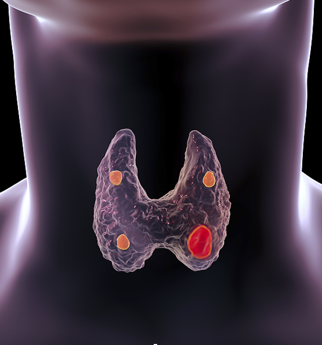 primary-hyperparathyroidism